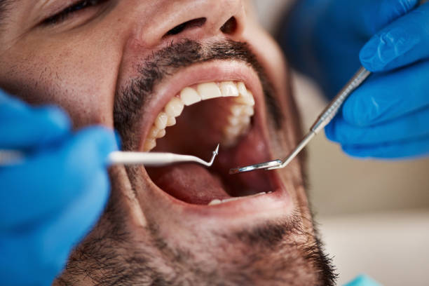 Best Urgent Tooth Repair  in Thermalito, CA