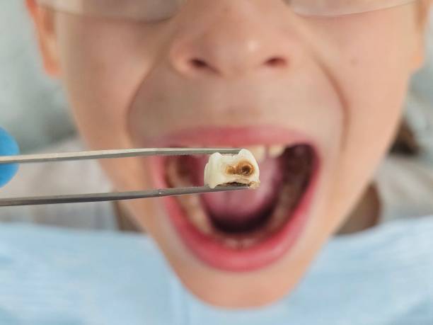 Best Dentist for Severe Toothache  in Thermalito, CA